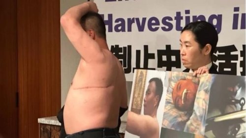 全球首位活摘幸存者亲述恐怖经历 美国政要谴责活摘野蛮 必须追责中共